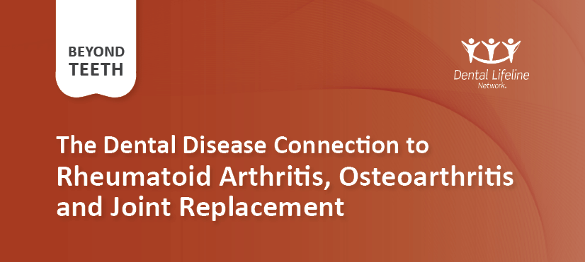 Rheumatoid Arthritis, Osteoarthritis, and Joint Replacement